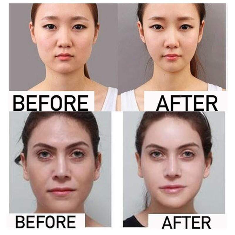 Ihrtrade Miracle V-Shaped Slimming Mask (2 Pieces/Set)