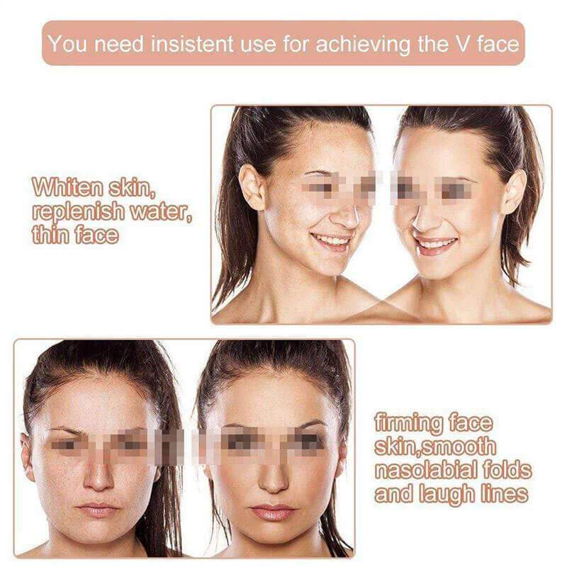 Ihrtrade Miracle V-Shaped Slimming Mask (2 Pieces/Set)