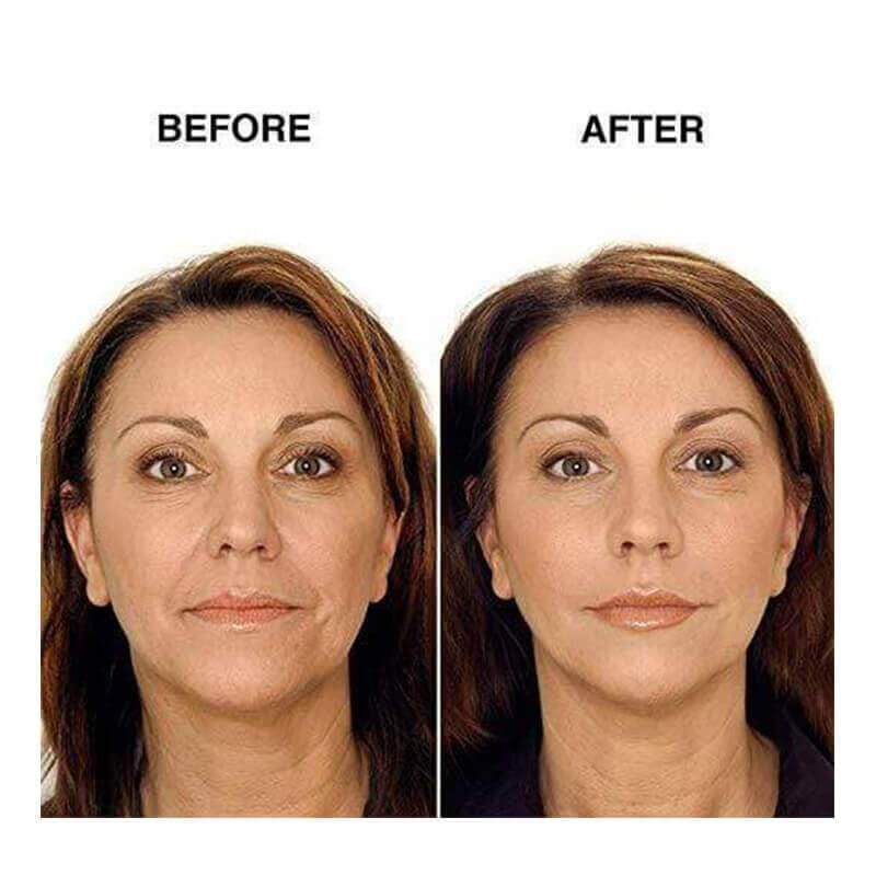 Ihrtrade Miracle V-Shaped Slimming Mask (2 Pieces/Set)