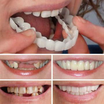It is DESIGNED to look like a NATURAL SET OF TEETH.