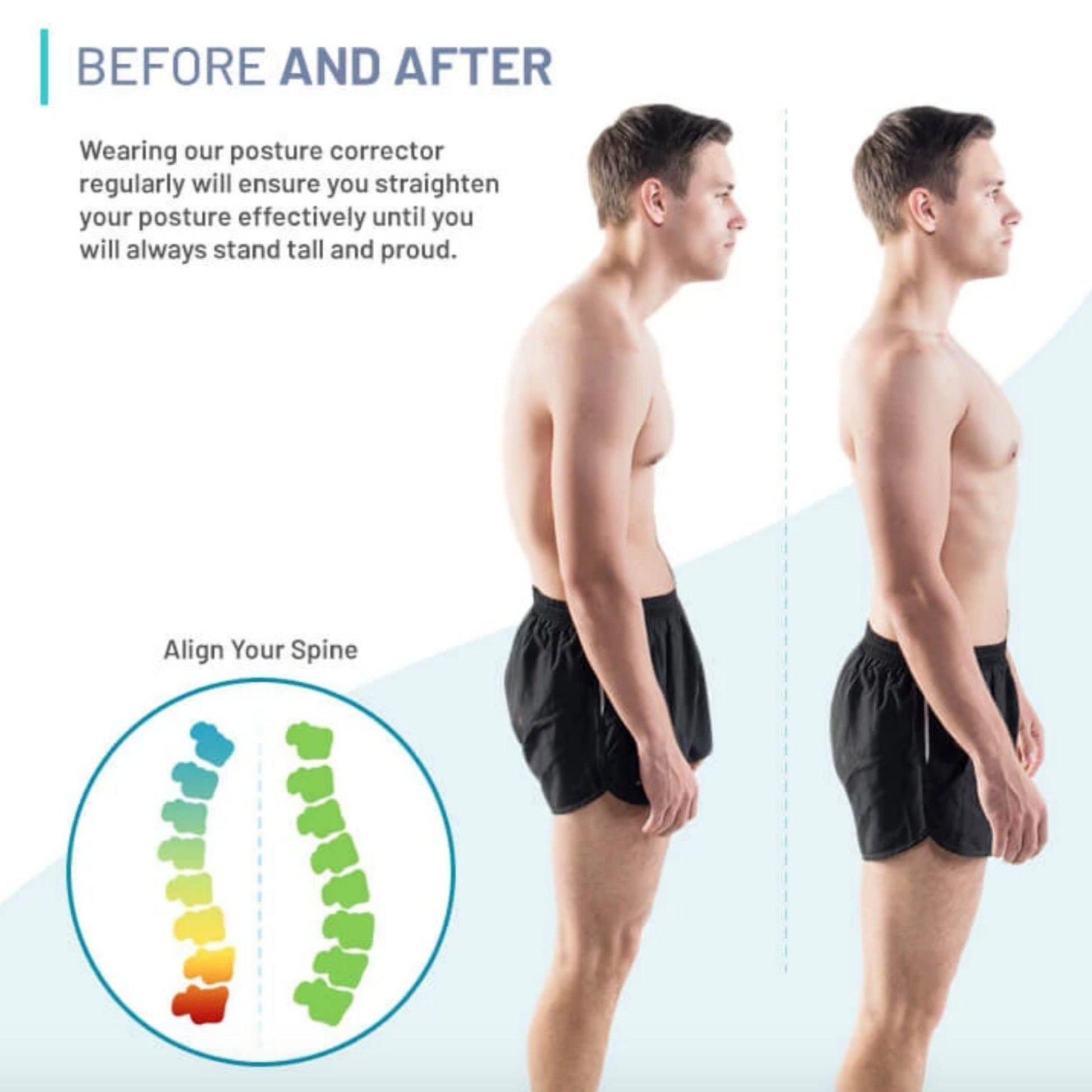 Ihrtrade Posture Corrector (4 sizes)